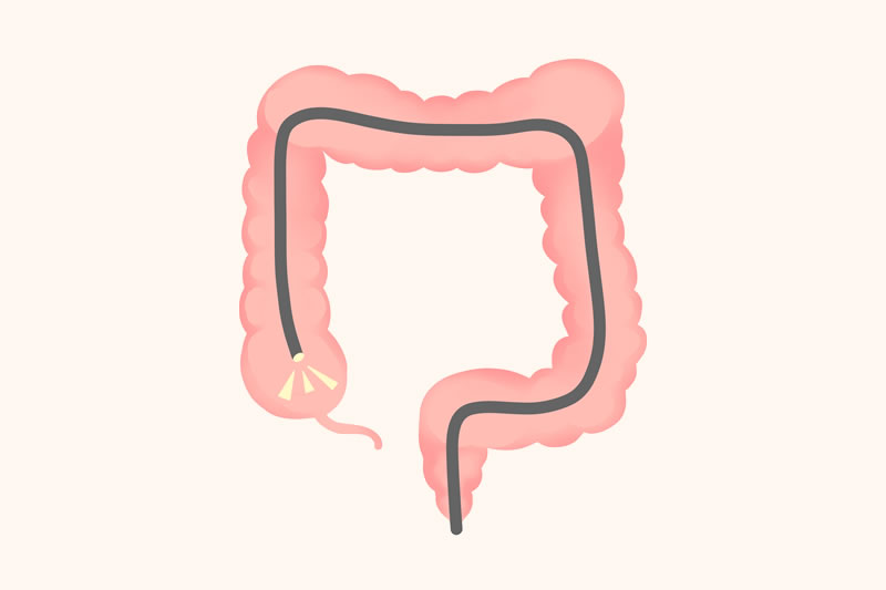 大腸内視鏡検査